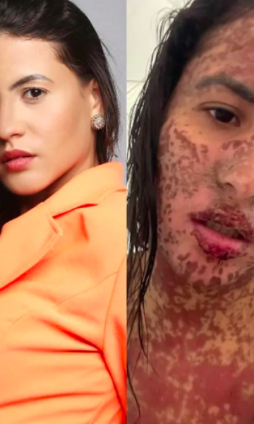 Entenda a doença rara que afetou a mulher de Frank Aguiar