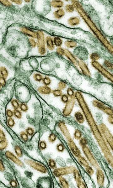 Qual a diferença entre vírus e bactéria?
