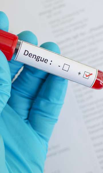 Sintomas de dengue que podem ser confundidos com outras doenças