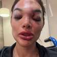 Dentista relata agressões do marido, empresário da Faria Lima, e cita taco de beisebol