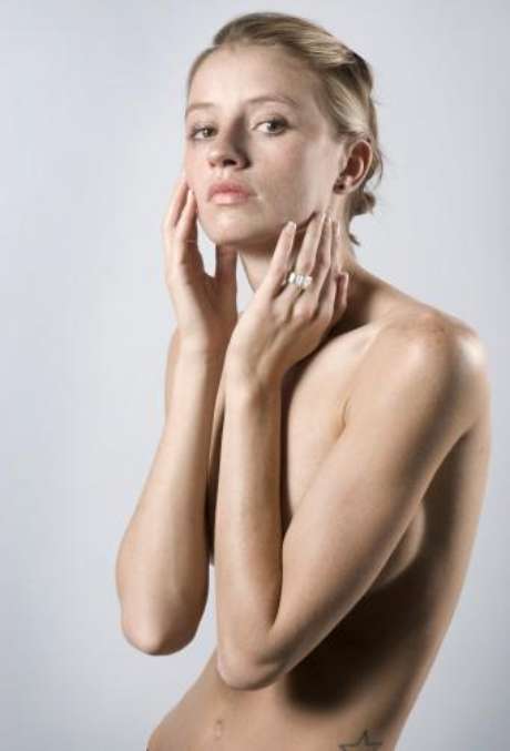 Los ungüentos inofensivos de atopicheskogo de la dermatitis