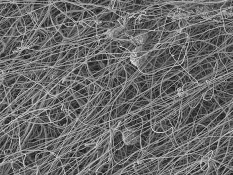 Imagem mostra 'molde' de nanofibras três dias após receber células-tronco <p>Imagem mostra 'molde' de nanofibras três dias após receber células-tronco</p>