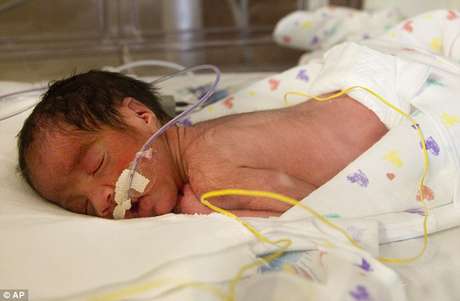 AP en español <p>Blaine Montalvo, el segundo de los bebes, pesó 3 libras y 15 onzas.</p>