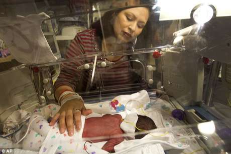 AP en español Tressa Montalvo dío a luz a un par de gemelos idénticos.