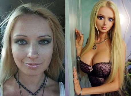 Imagenes de la barbie humana antes y despues de adelgazar