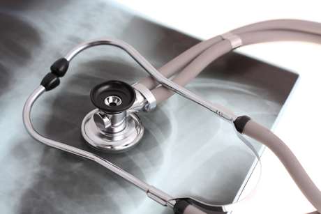 Thinksotck <p>La tuberculosis es una de las enfermedades con mayor índice de mortalidad en el mundo.</p>