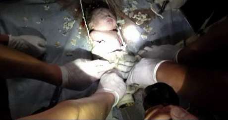 EFE en español El video muestra rescatadores serruchando una sección de la tubería para rescatar al bebé.