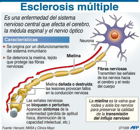 Resultado de imagen de esclerosis multiple