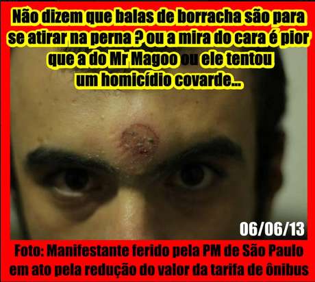 Uma foto de um suposto manifestante, ferido por bala de borracha, circulou pelas redes sociais <p>Uma foto de um suposto manifestante, ferido por bala de borracha, circulou pelas redes sociais</p>