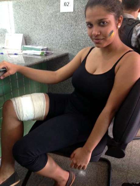 Larissa Souza foi baleada na perna com um projétil de borracha durante as manifestações Larissa Souza foi baleada na perna com um projétil de borracha durante as manifestações