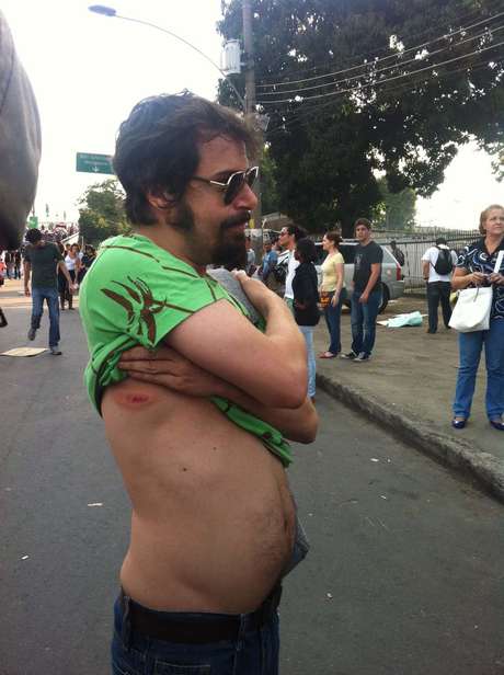 O editor de imagens Pedro Serra, 44, foi atingido por uma bala de borracha <p>O editor de imagens Pedro Serra, 44, foi atingido por uma bala de borracha</p>