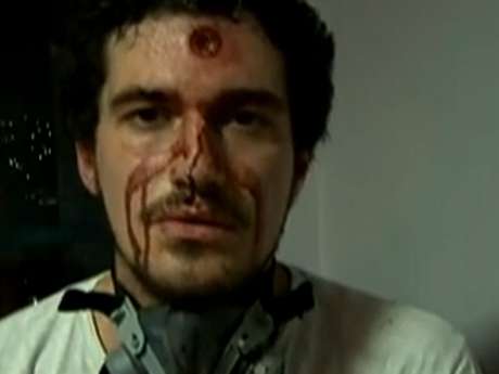 Repórter gravou vídeo ensanguentado após ser atingido durante confrontos nos protestos no Rio de Janeiro Repórter gravou vídeo ensanguentado após ser atingido durante confrontos nos protestos no Rio de Janeiro