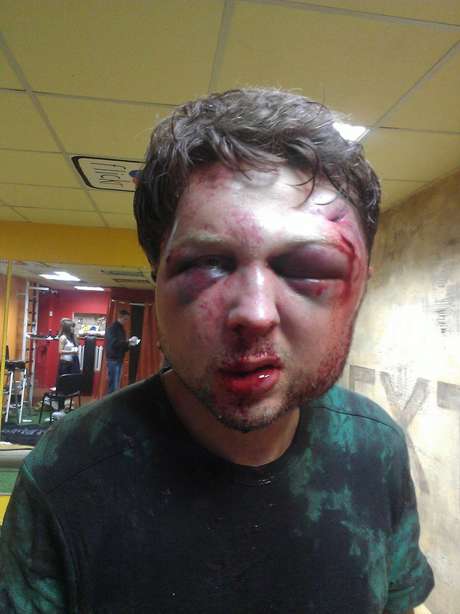 Imagem divulgada pelo Femen mostra Viktor Sviatski com as marcas da agressão <p>Imagem divulgada pelo Femen mostra Viktor Sviatski com as marcas da agressão</p>