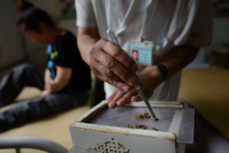 Pacientes afirmam ter sido curados até do câncer após as dolorosas sessões com abelhas Pacientes afirmam ter sido curados até do câncer após as dolorosas sessões com abelhas