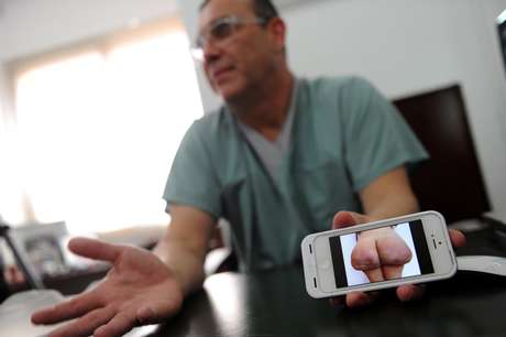 O cirurgião plástico Daniel Slobodianik mostra imagem de mulher que optou pela injeção do gel bipolímero O cirurgião plástico Daniel Slobodianik mostra imagem de mulher que optou pela injeção do gel bipolímero