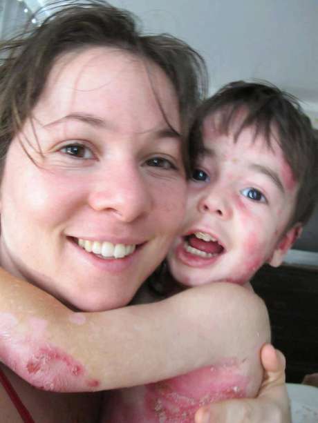 Theo, que completa 4 anos nesta quarta, ao lado da mãe <p>Theo, que completa 4 anos nesta quarta, ao lado da mãe</p>