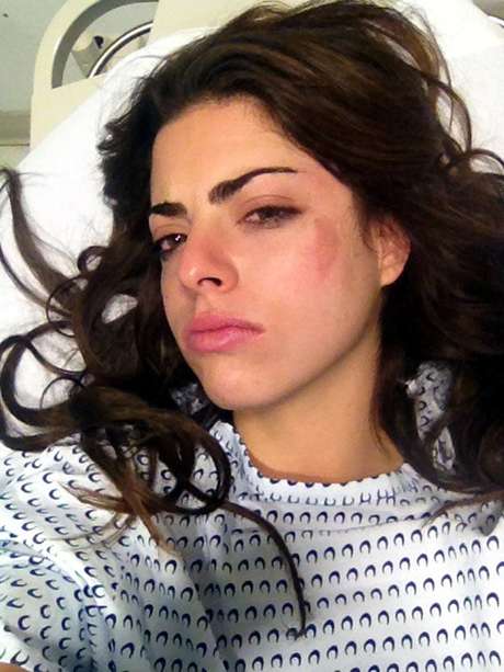 Reforma <p><span style="color: rgb(51, 51, 51); font-family: arial; font-size: 13px; line-height: normal;">Isabel Burr, protagonista de 'Niñas Mal 2', sufrió golpes en el rostro y usará collarín.</span></p>