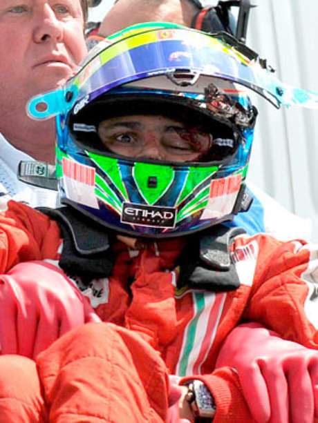 Massa Acidente Mais Grave Apos Senna Foi O Que Sofri