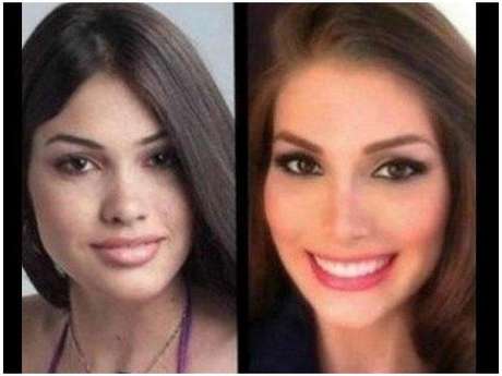 El resfriado los hinchazones bajo los ojos