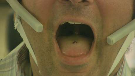 O piercing do tamanho de um feijão produz um campo magnético que muda quando a língua se movimenta O piercing do tamanho de um feijão produz um campo magnético que muda quando a língua se movimenta