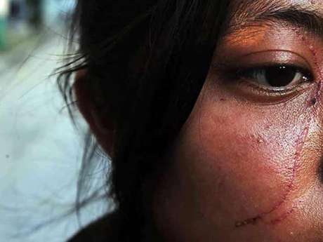 Alberto Neri / Reforma El Copred ha documentado que agresiones por discriminación, además de lesiones físicas, afectan emocionalmente a las personas.