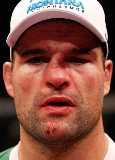 Nariz de Shogun ficou fora do lugar após o soco de Henderson Nariz de Shogun ficou fora do lugar após o soco de Henderson