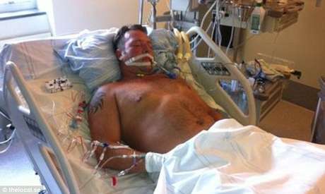 Jimi Fritze, 43 anos, só teve a vida salva porque outro médico, que retornou de férias, achou conveniente avaliar melhor suas condições Jimi Fritze, 43 anos, só teve a vida salva porque outro médico, que retornou de férias, achou conveniente avaliar melhor suas condições