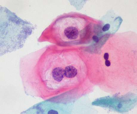 HPV continua sendo a fonte de infecção venérea mais frequente nos Estados Unidos. Na imagem, imagem do vírus, vista em laboratório <p>HPV continua sendo a fonte de infecção venérea mais frequente nos Estados Unidos. Na imagem, imagem do vírus, vista em laboratório</p>