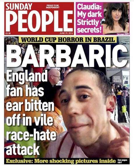 Sunday People mostra o torcedor sem um pedaço da orelha após a partida entre Inglaterra e Uruguai Sunday People mostra o torcedor sem um pedaço da orelha após a partida entre Inglaterra e Uruguai