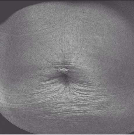 Mãe manda foto da barriga após dar à luz menino Mãe manda foto da barriga após dar à luz menino