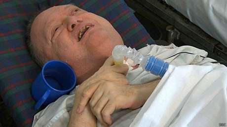 Norberto Butler, de 57 anos, passou a maior parte da vida em um hospital Norberto Butler, de 57 anos, passou a maior parte da vida em um hospital