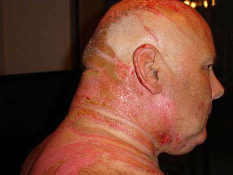Gregory disse que Teresa Gilbertson, 60 anos, ficou o agredindo verbalmente por semanas, antes de ser atacado Gregory disse que Teresa Gilbertson, 60 anos, ficou o agredindo verbalmente por semanas, antes de ser atacado