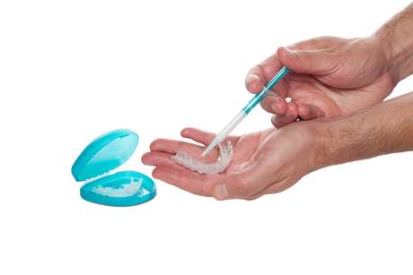 No clareamento caseiro, a pessoa uma moldeira de silicone com gel clareador por um período de 30 minutos a 8 horas todos os dias durante um mês No clareamento caseiro, a pessoa uma moldeira de silicone com gel clareador por um período de 30 minutos a 8 horas todos os dias durante um mês