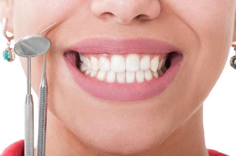 iStock El cepillado de dientes después de cada comida es fundamental para evitar la caries