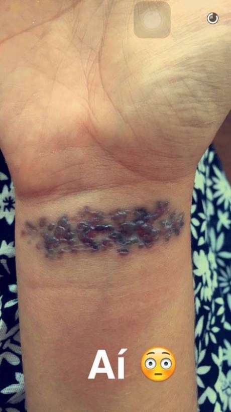yasmin brunet remove tatuagem do pulso e compartilha resultado yasmin brunet remove tatuagem do pulso e compartilha resultado