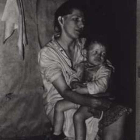 Menina com malária no colo da mãe; ocorrência da doença era crônico no sul dos EUA Menina com malária no colo da mãe; ocorrência da doença era crônico no sul dos EUA