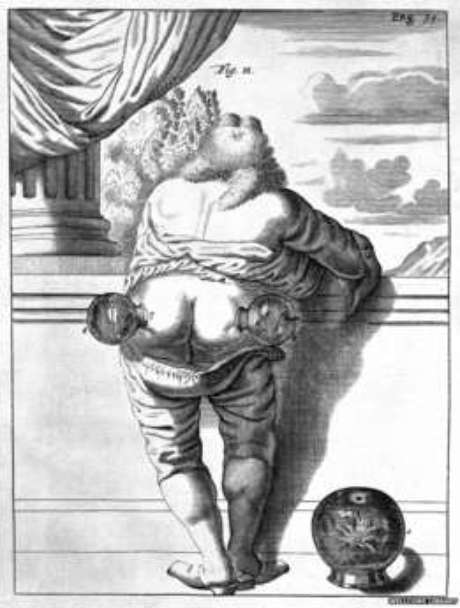 Uma ilustração de um livro de medicina publicado em 1694 mostra um homem passando pela terapia