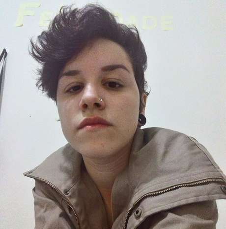 Estudante perdeu a visão durante o protesto contra o impeachment da presidente Dilma, no dia 31 de agosto em São Paulo Estudante perdeu a visão durante o protesto contra o impeachment da presidente Dilma, no dia 31 de agosto em São Paulo