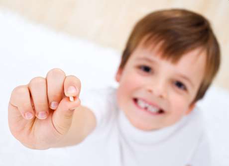 O ideal para coleta de células-tronco é que os dentes sejam extraídos no consultório do dentista, para que a polpa do dente continue viva. O ideal para coleta de células-tronco é que os dentes sejam extraídos no consultório do dentista, para que a polpa do dente continue viva.