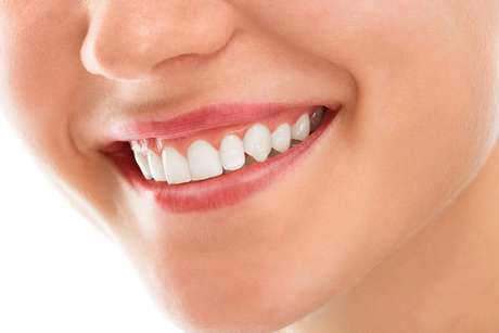 Apesar de não parecer, a gengivoplastia é um procedimento de valor bastante acessível. A maioria dos profissionais cobra por dente, então depende de quantas reparações a pessoa deseja fazer. Apesar de não parecer, a gengivoplastia é um procedimento de valor bastante acessível. A maioria dos profissionais cobra por dente, então depende de quantas reparações a pessoa deseja fazer.