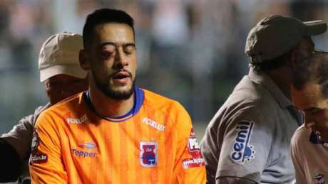 Goleiro paranista irá passar por um procedimento cirúrgico nos próximos dias (Foto: Pedro Vale/eleven Goleiro paranista irá passar por um procedimento cirúrgico nos próximos dias (Foto: Pedro Vale/eleven