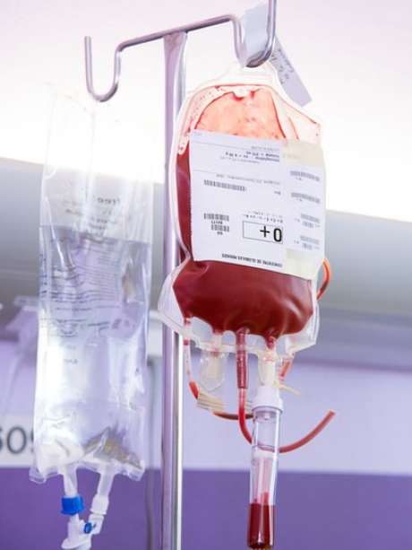 SPL / BBCBrasil.com Testes em ratos mostram promissores, mas acreditam que ainda é cedo demais para usar a parabiose em humanos
