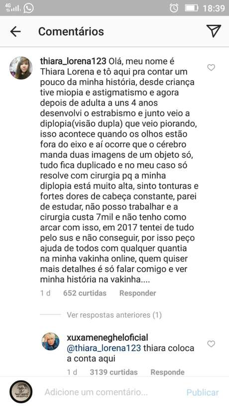 Xuxa Meneghel responde a menina que pediu ajuda para custear cirurgia Xuxa Meneghel responde a menina que pediu ajuda para custear cirurgia