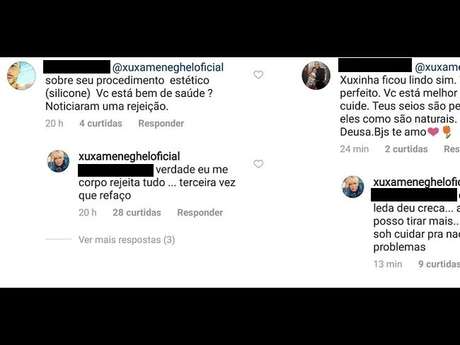 Xuxa Meneghel tranquilizou os fãs no Instagram sobre a cirurgia que foi submetida para trocar as próteses de silicone Xuxa Meneghel tranquilizou os fãs no Instagram sobre a cirurgia que foi submetida para trocar as próteses de silicone