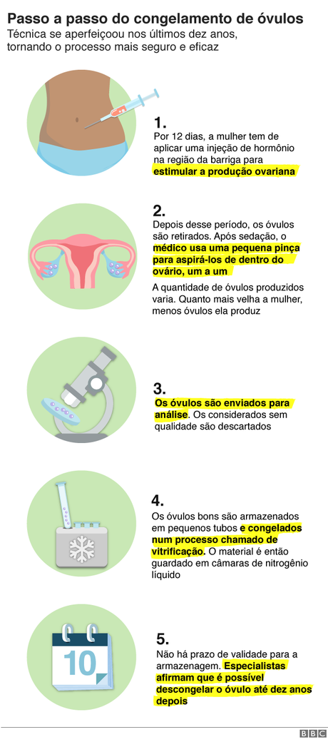 Infográfico com o passo a passo do congelamento de óvulos