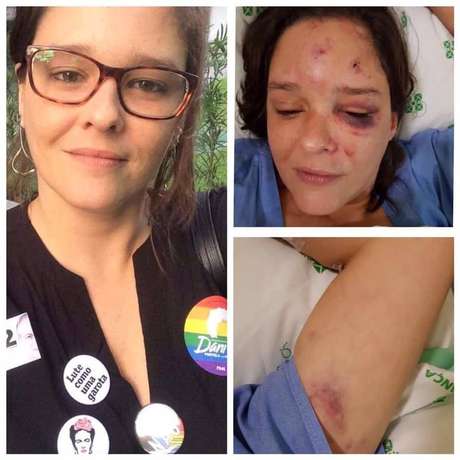 A vítima ficou com hematomas pelo rosto e teve um dos braços quebrados. A vítima ficou com hematomas pelo rosto e teve um dos braços quebrados.