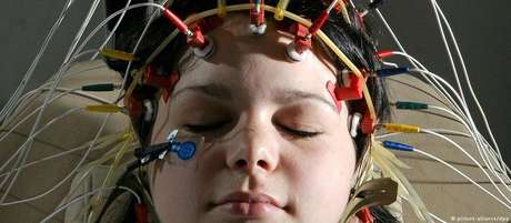 Pesquisa monitorou as atividades cerebrais de pacientes que tiveram seus crânios abertos para procedimentos cirúrgicos Pesquisa monitorou as atividades cerebrais de pacientes que tiveram seus crânios abertos para procedimentos cirúrgicos