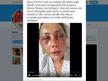 Empresária aparece com o rosto inchado e ferido em vÃdeo postado no Twitter