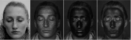 Da esq. para a dir.: rosto fotografado com câmera normal, com câmera UV; com filtro solar e com hidratante