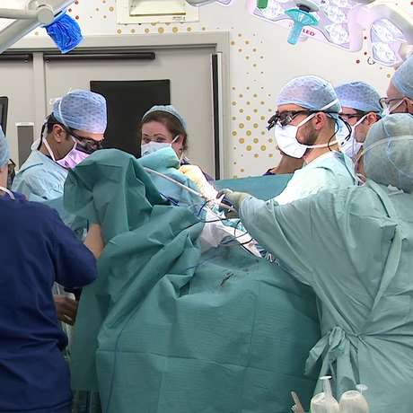 As meninas tiveram de passar por três cirurgias para serem separadas As meninas tiveram de passar por três cirurgias para serem separadas